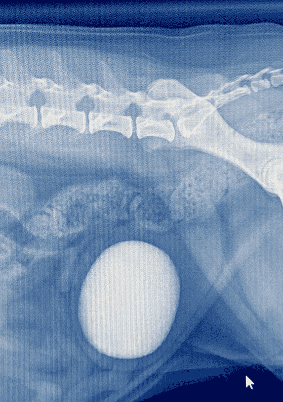 CT Scanning (Computed Tomography)