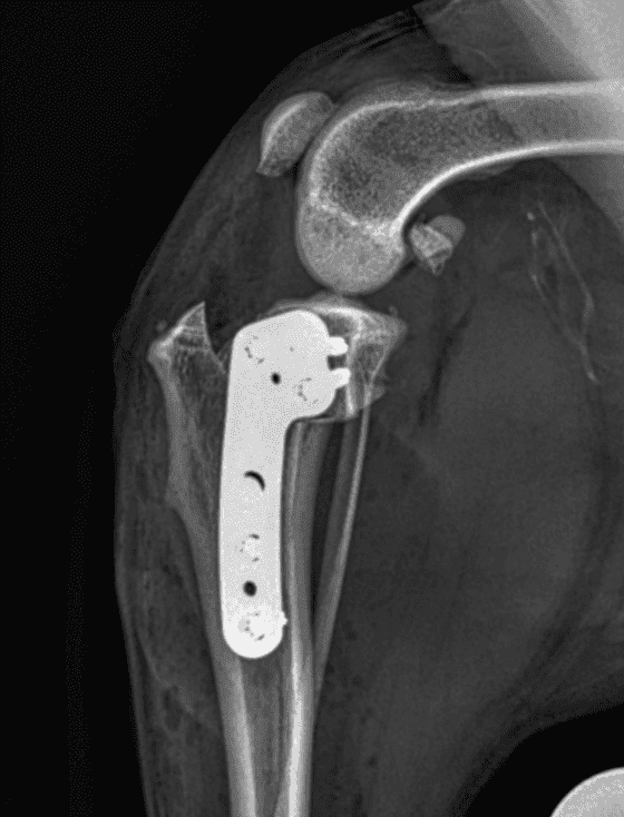 TPLO Surgery for Cruciate Disease in Dogs